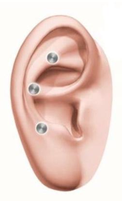COCHLEAR